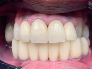 Smile Dental JC | Pediatric Dentistry, Teeth Whitening and Oral Cancer Screening