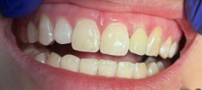 Smile Dental JC | Digital Radiography, Periodontal Treatment and Oral Cancer Screening