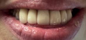 Smile Dental JC | Periodontal Treatment, Dental Cleanings and Oral Exams