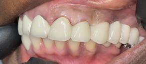 Smile Dental JC | Digital Radiography, Air Abrasion and Dental Fillings