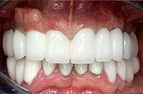 Smile Dental JC | Air Abrasion, Dental Cleanings and Preventative Program