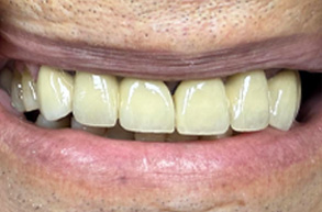 Smile Dental JC | Root Canals, Pediatric Dentistry and Oral Exams