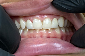 Smile Dental JC | Dentures, Sports Mouthguards and Cosmetic Dentistry