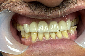 Smile Dental JC | Pediatric Dentistry, Implant Dentistry and CBCT