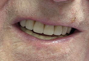 Smile Dental JC | Cosmetic Dentistry, Periodontal Treatment and Air Abrasion