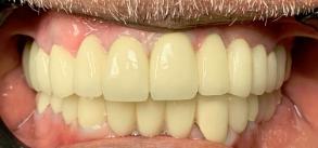 Smile Dental JC | CBCT, Dental Cleanings and Laser Dentistry