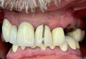 Smile Dental JC | Digital Impressions, Oral Cancer Screening and Cosmetic Dentistry