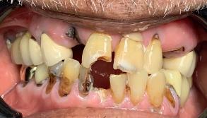 Smile Dental JC | Dentures, Digital Impressions and Oral Exams