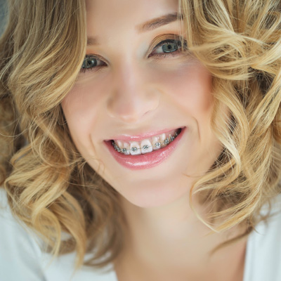 A woman with a radiant smile and braces, posing for a portrait.