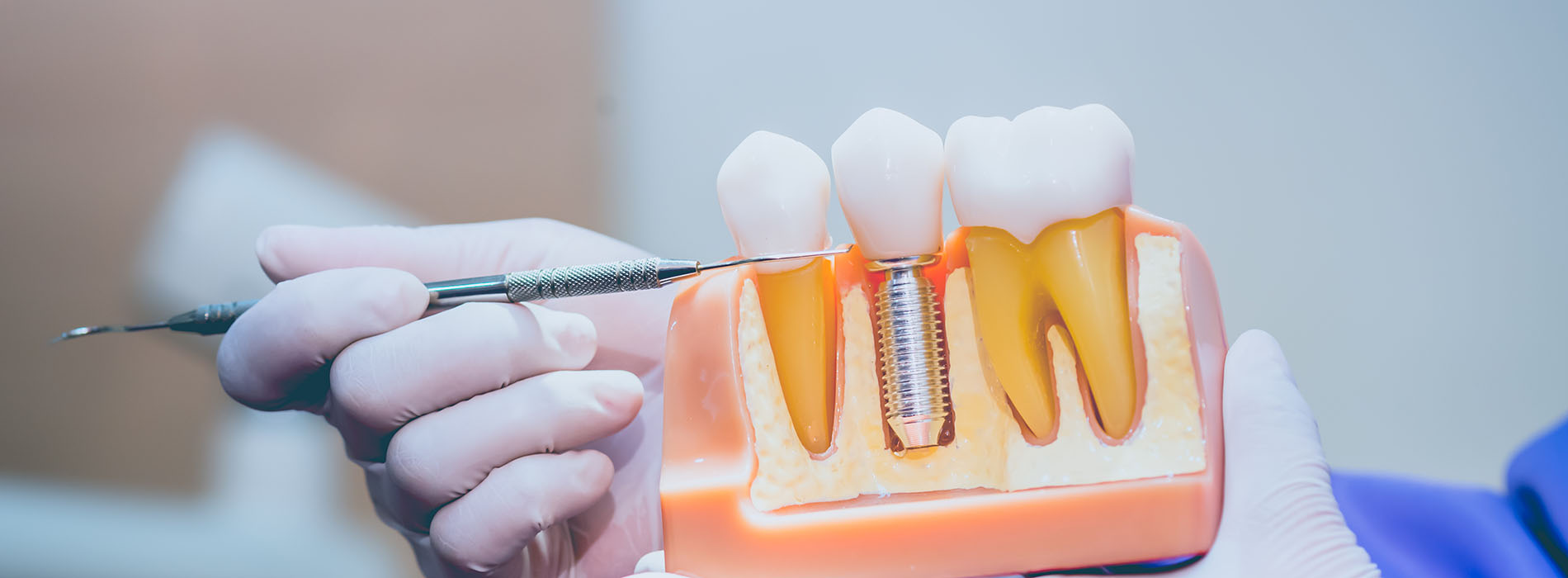 An image of a person using dental tools to adjust or repair teeth, with a close-up view of an open mouth and dental instruments.