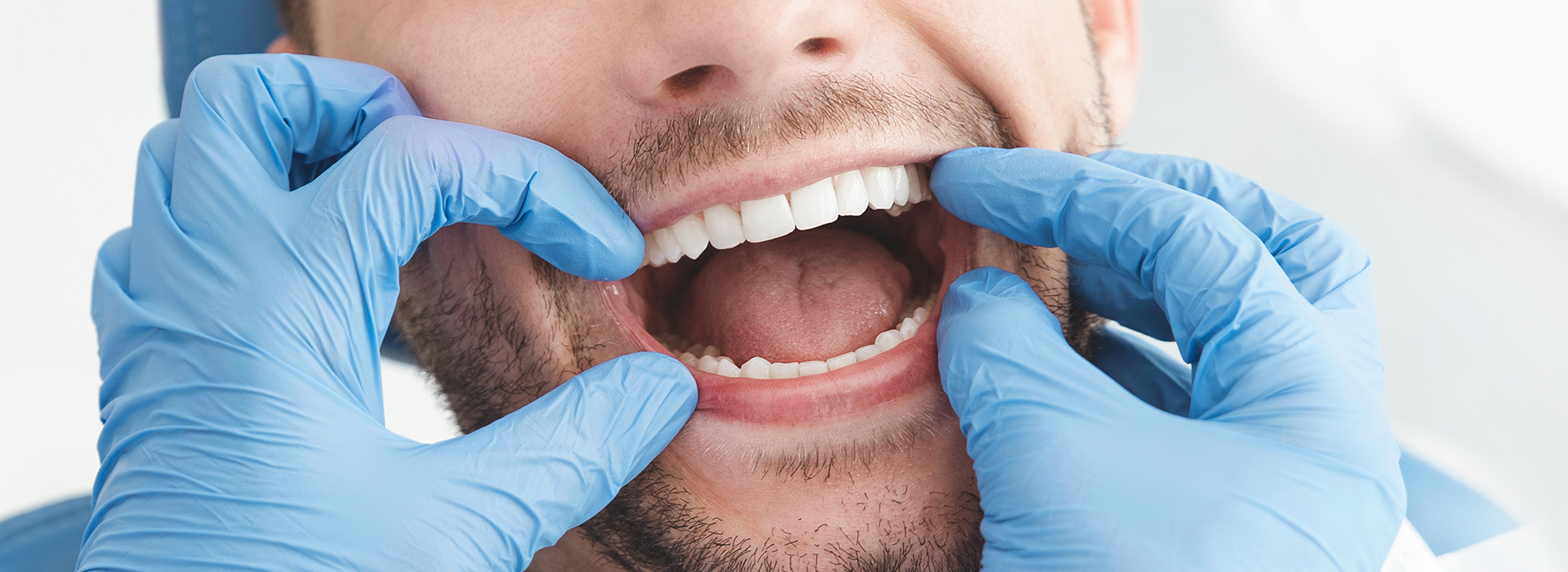 The image shows a man with a broad smile, wearing blue gloves and holding his mouth open wide.