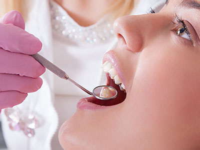 A dental professional performing a dental procedure on a patient s teeth using dental instruments.